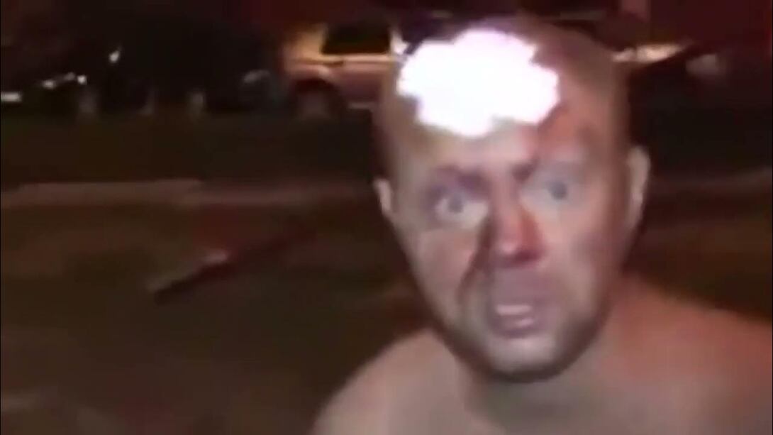 1000051472