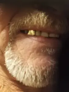 Грилзы золотые для декорирования (с картой OZON, из-за рубежа)